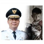 Gubernur dan bayi lahir tanpa anus